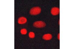ABIN6269045 staining MCF-7 cells by ICC/IF. (CHEK1 Antikörper  (Internal Region))