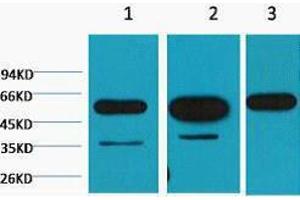 Western Blotting (WB) image for anti-Tubulin, beta (TUBB) antibody (ABIN3178688) (TUBB Antikörper)