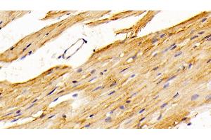 Detection of SPR in Mouse Cardiac Muscle Tissue using Polyclonal Antibody to Sepiapterin Reductase (SPR) (SPR Antikörper  (AA 1-261))