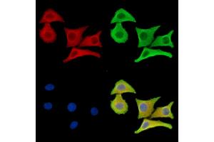 ABIN7096535 and ABIN7100599 staining Hela cells by IF/ICC. (LASS1 Antikörper)