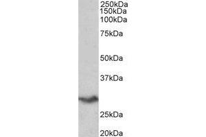 Western Blotting (WB) image for anti-V-Set Domain Containing T Cell Activation Inhibitor 1 (VTCN1) (Internal Region) antibody (ABIN2465019) (VTCN1 Antikörper  (Internal Region))