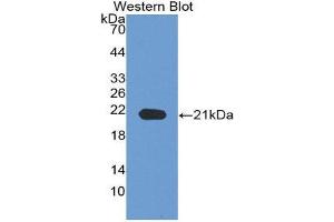 Western Blotting (WB) image for anti-Neuropilin 1 (NRP1) (AA 646-814) antibody (ABIN3201480) (Neuropilin 1 Antikörper  (AA 646-814))