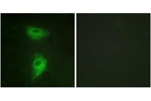 Immunofluorescence analysis of HeLa cells, using IGF2R (Ab-2409) Antibody. (IGF2R Antikörper  (AA 2381-2430))