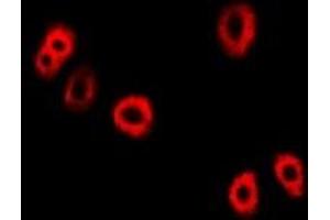 Immunofluorescent analysis of UBE2C staining in Hela cells. (UBE2C Antikörper)