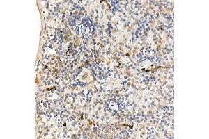 Immunohistochemistry of paraffin-embedded mouse spleen using c-Abl Rabbit pAb (ABIN3020871, ABIN3020872, ABIN3020873 and ABIN6213767) at dilution of 1:25 (40x lens).