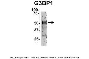 IP Suggested Anti-G3BP1 Antibody Positive Control: NT2 CELL/BRAIN TISSUE (G3BP1 Antikörper  (N-Term))