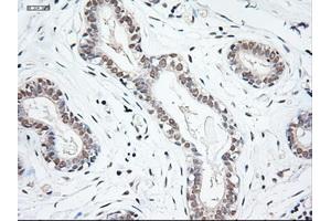 Immunohistochemical staining of paraffin-embedded breast using anti-NTF3 (ABIN2452683) mouse monoclonal antibody. (Neurotrophin 3 Antikörper  (AA 139-257))