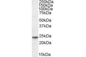 ABIN185188 (0. (Transgelin Antikörper  (C-Term))