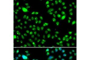 Immunofluorescence analysis of MCF-7 cells using L3MBTL3 Polyclonal Antibody (L3MBTL3 Antikörper)