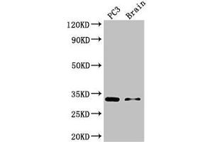 Western Blot Positive WB detected in: PC-3 whole cell lysate, Mouse brain tissue All lanes: HOXB13 antibody at 3 μg/mL Secondary Goat polyclonal to rabbit IgG at 1/50000 dilution Predicted band size: 31 kDa Observed band size: 31 kDa (HOXB13 Antikörper  (AA 1-161))
