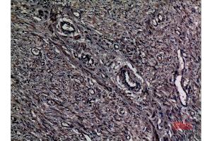 Immunohistochemistry (IHC) analysis of paraffin-embedded Human Uterus, antibody was diluted at 1:100.
