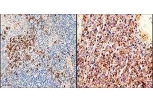 Immunohistochemistry (IHC) image for Rabbit anti-Human Ig (C-Term), (Chain kappa), (Light Chain) antibody (ABIN870368)