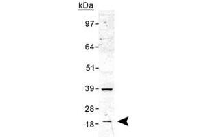 Western blot analysis of TMED10 in human liver lysate with TMED10 polyclonal antibody . (TMED10 Antikörper  (AA 50-150))