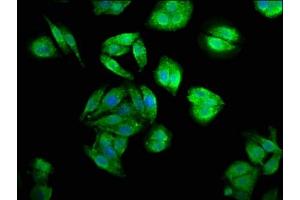Immunofluorescence staining of HepG2 cells with ABIN7147362 at 1:200, counter-stained with DAPI. (CENPJ Antikörper  (AA 1082-1248))