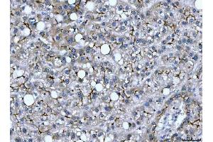 IHC analysis of DEP1/PTPRJ using anti-DEP1/PTPRJ antibody (ABIN7600061).