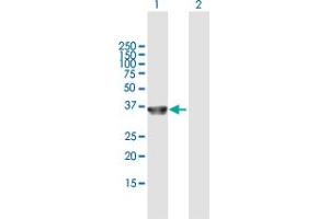 Western Blot analysis of COL23A1 expression in transfected 293T cell line by COL23A1 MaxPab polyclonal antibody. (COL23A1 Antikörper  (AA 1-309))