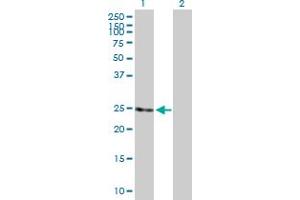 Western Blot analysis of RAB11B expression in transfected 293T cell line by RAB11B MaxPab polyclonal antibody.