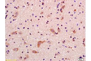 Immunohistochemistry (IHC) image for anti-Glutamate Receptor, Ionotropic, delta 2 (Grid2) Interacting Protein (GRID2IP) (AA 921-1020) antibody (ABIN1386525)