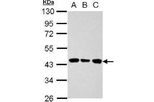 WB Image Sample (30 ug of whole cell lysate) A: 293T B: A431 C: HeLa 10% SDS PAGE antibody diluted at 1:1000 (ALDOB Antikörper)