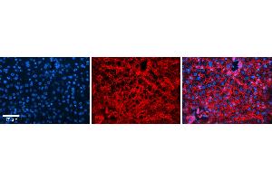 Rabbit Anti-CD81 Antibody Catalog Number: ARP63231_P050 Formalin Fixed Paraffin Embedded Tissue: Human Liver Tissue Observed Staining: Cytoplasm and plasma membrane in hepatocytes and endothelial cells in sinusoids Primary Antibody Concentration: 1:100 Other Working Concentrations: 1:600 Secondary Antibody: Donkey anti-Rabbit-Cy3 Secondary Antibody Concentration: 1:200 Magnification: 20X Exposure Time: 0. (CD81 Antikörper  (C-Term))