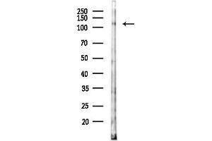 Western blot analysis of lysates from HUVEC cells(LPS 4h treatment), using Phospho-ASK1 (Thr845) Antibody at 1/1000 dilution.