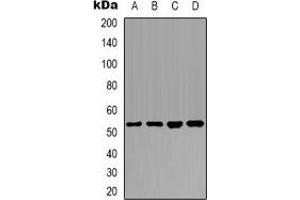 Western blot analysis of PTEN expression in Hela (A), MCF7 (B), NIH3T3 (C), mouse brain (D) whole cell lysates. (PTEN Antikörper  (C-Term))