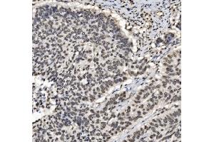 IHC analysis of DBC-1/CCAR2 using anti-DBC-1/CCAR2 antibody (ABIN7602235).