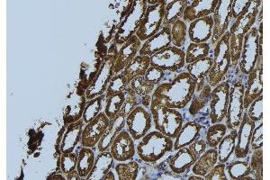 ABIN6272356 at 1/100 staining Rat kidney tissue by IHC-P. (NDUFS5 Antikörper  (C-Term))