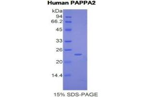 SDS-PAGE analysis of Human Pappalysin 2 Protein.