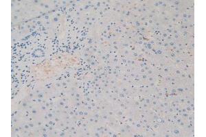 Figure. (SIRPA Antikörper  (AA 105-324))