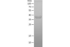 Caldesmon Protein (AA 1-250) (His tag)