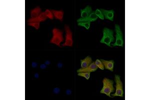 ABIN7093100 and ABIN7097254 staining Hela cells(heat shock treatment) by IF/ICC. (MLKL Antikörper  (pSer347))
