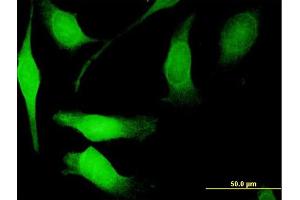 Immunofluorescence of purified MaxPab antibody to NGFRAP1 on HeLa cell.