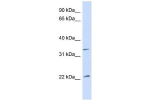 Western Blot showing ARF1 antibody used at a concentration of 1. (ARF1 Antikörper  (Middle Region))