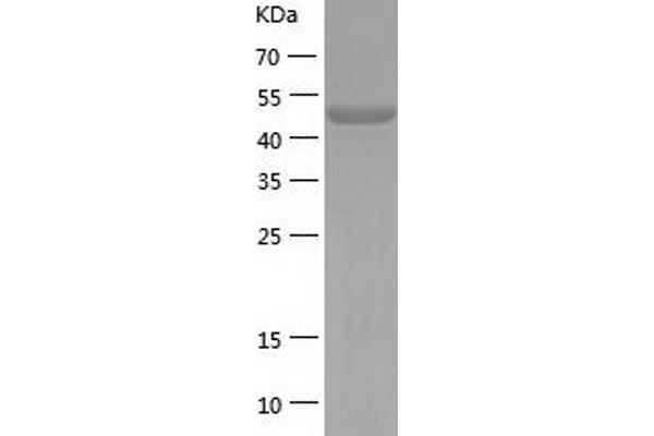 FUCA1 Protein (AA 18-452) (His tag)