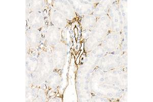 Immunohistochemistry of paraffin-embedded mouse kidney using Annexin  Rabbit pAb  at dilution of 1:25 (40x lens). (Annexin A2 Antikörper)