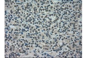 Immunohistochemical staining of paraffin-embedded Ovary tissue using anti-NEK6mouse monoclonal antibody. (NEK6 Antikörper)