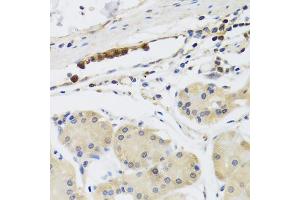 Immunohistochemistry of paraffin-embedded human stomach using MB21D1 antibody. (C6orf150 Antikörper)