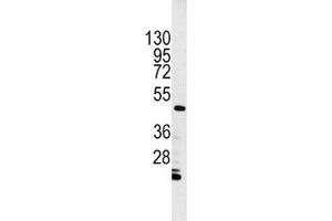 Western Blotting (WB) image for anti-Integrin-Linked Kinase (ILK) (AA 11-41) antibody (ABIN3031392)