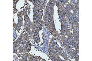 IHC analysis of LI Cadherin/CDH17 using anti-LI Cadherin/CDH17 antibody (ABIN7600855).