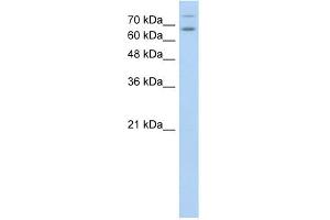 WB Suggested Anti-TSHR Antibody Titration:  0. (TSH receptor Antikörper  (N-Term))