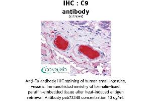Image no. 1 for anti-Complement Component C9 (C9) (AA 184-411) antibody (ABIN1732510) (C9 Antikörper  (AA 184-411))