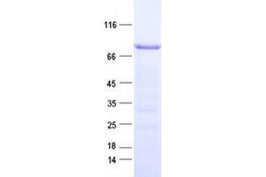 ZNF285 Protein (His tag)