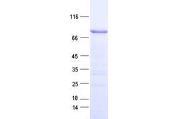 ZNF285 Protein (His tag)