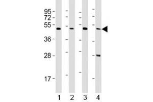 Western blot testing of CTBP1 antibody at 1:2000 dilution.