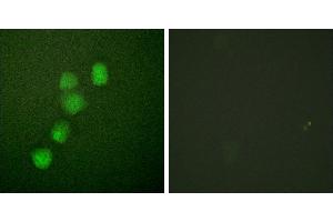 Peptide - +Immunofluorescence analysis of HuvEc cells, using Cyclin(Ab-395) antibody (#B0069). (Cyclin E1 Antikörper  (Thr395))