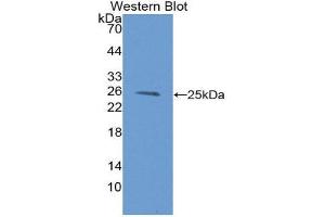 Western Blotting (WB) image for anti-Proteasome (Prosome, Macropain) Subunit, beta Type, 9 (Large Multifunctional Peptidase 2) (PSMB9) (AA 22-219) antibody (ABIN1980450) (PSMB9 Antikörper  (AA 22-219))
