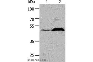 Western blot analysis of HepG2 cell and Mouse brain tissue, using HTR1A Polyclonal Antibody at dilution of 1:1000 (Serotonin Receptor 1A Antikörper)