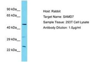 Image no. 1 for anti-Sterile alpha Motif Domain Containing 7 (SAMD7) (AA 175-224) antibody (ABIN6750794) (SAMD7 Antikörper  (AA 175-224))