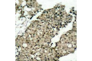 Immunohistochemistry (IHC) image for anti-GTPase Activating Protein (SH3 Domain) Binding Protein 1 (G3BP1) (pSer232) antibody (ABIN3020220) (G3BP1 Antikörper  (pSer232))